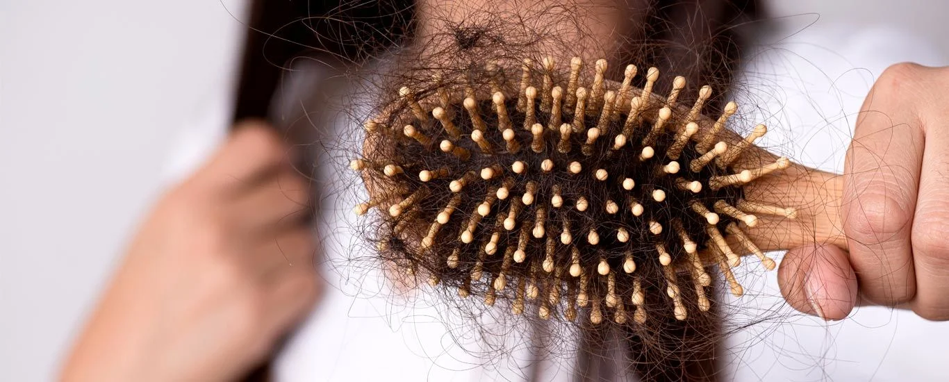 آزمایش های مربوط به تشخیص ریزش مو