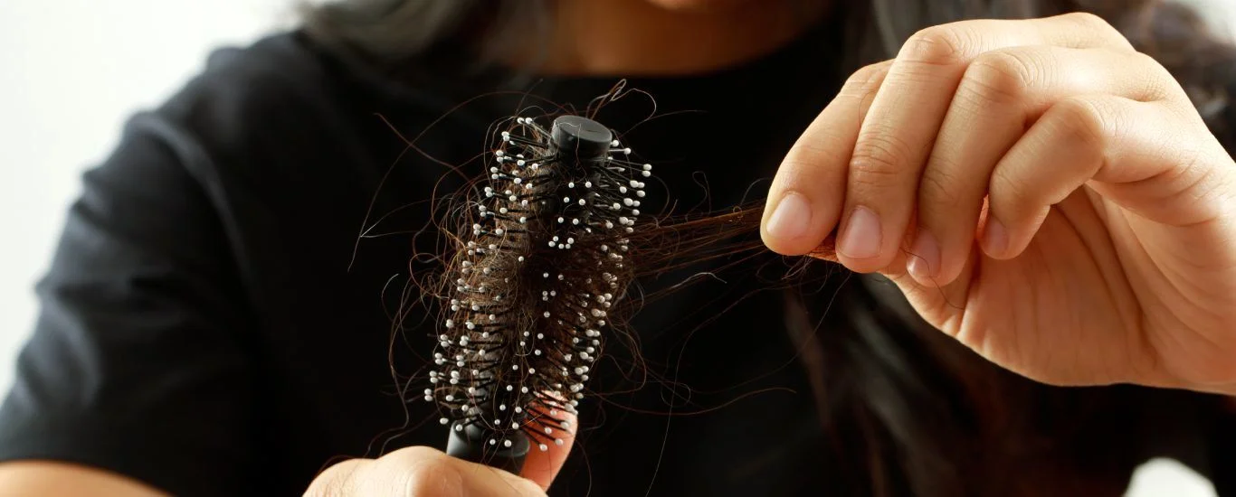 ترفندهایی برای درمان ریزش مو ارثی در خانه