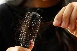 ترفندهایی برای درمان ریزش مو ارثی در خانه