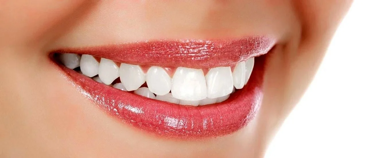 سفید کردن دندان ها به روش گیاهی و طبیعی