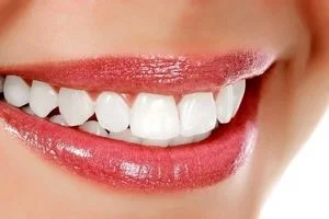 سفید کردن دندان ها به روش گیاهی و طبیعی