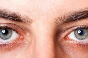 بهترین راه حل های خانگی برای درمان خشکی چشم 